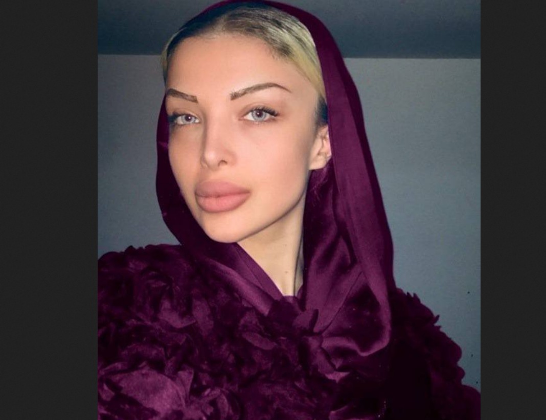 عکس همسر سپهر حیدری قبل از عمل